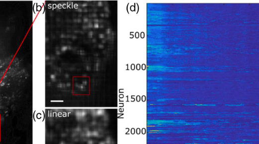 Brain-wide 3D light-field imaging of neuronal activity with speckle-enhanced resolution