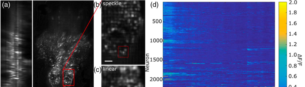 Brain-wide 3D light-field imaging of neuronal activity with speckle-enhanced resolution